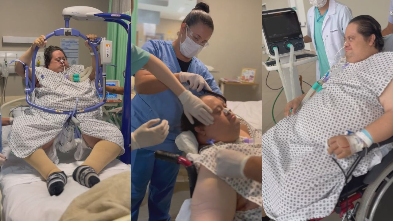 paciente-com-elefantiase-e-icado-para-sentir-o-sol-pela-1a-vez-em-muito-tempo-em-hospital-de-divinopolis