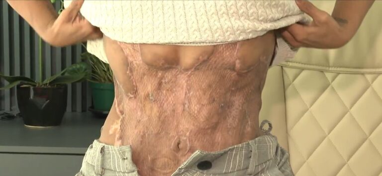 cirurgiao-plastico-indiciado-florianopolis